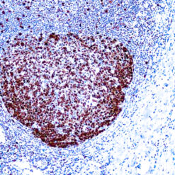 Formalin fixed paraffin embedded human tonsil stained with CD20 antibody (PDM004) labeled with High Contrast DAB (K055) produces a dark chocolate brown color.