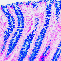 Human Colon Stained with Alcian Blue (KT003).