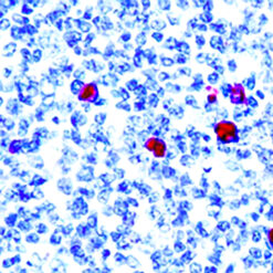 Formalin fixed paraffin embedded human tonsil stained with IgM antibody.