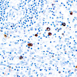 Formalin fixed paraffin embedded human spleen stained with IgM antibody.