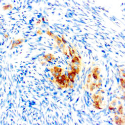 Formalin fixed paraffin embedded human ovary stained with Inhibin α antibody.