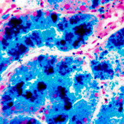 Iron Deposits in Liver Stained with Iron Stain (KT021).