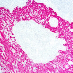 Formalin fixed paraffin embedded human tonsil stained with Cytokeratin H.M.W antibody (PDM 074) labeled with PermaRed/APAuto Chromogen (K049)