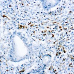 Formalin fixed paraffin embedded human Tonsil stained with Kappa Light Chain.