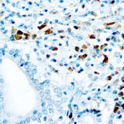 Formalin fixed paraffin embedded human tonsil stained with Kappa Light Chain antibody.