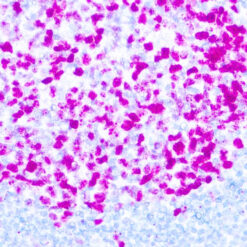 Formalin fixed paraffin embedded human tonsil stained with Ki-67 antibody.