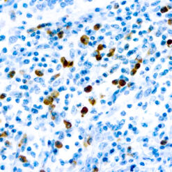 Formalin fixed paraffin embedded human tonsil stained with Lambda Light Chain antibody.