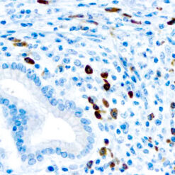 Formalin fixed paraffin embedded human tonsil stained with Lambda Light Chain antibody.