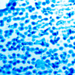 Luxol Fast Blue stain on brain (KT022).