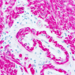 Formalin fixed paraffin embedded human large intestine stained with Actin, Smooth Muscle