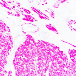 Formalin fixed paraffin embedded human large intestine stained with Actin, Muscle Specific