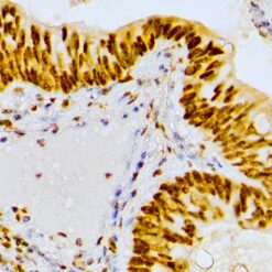Formalin fixed paraffin embedded human Tonsil stained with MSH2
