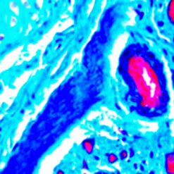 Massons Trichrome Stain on Lung Tissue (KT034)