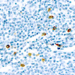 Formalin fixed paraffin embedded human tonsil stained with Mast Cell Chymase antibody.