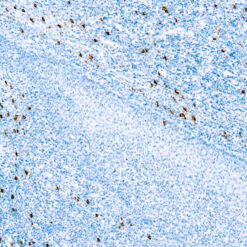 Formalin fixed paraffin embedded human tonsil stained with Mast Cell Tryptase antibody.