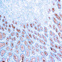 Formalin fixed paraffin embedded human stomach stained with Mucin 5AC antibody.