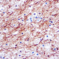 Formalin fixed paraffin embedded human brain stained with Neurofilaments antibody.