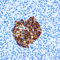 Formalin fixed paraffin embedded human pancreas stained with Chromogranin A antibody.