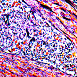 PTAH Stain on Uterus (KT029).