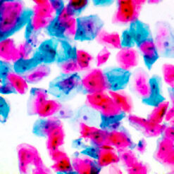 Human Cervical smear stained with PAP stain (KT038).