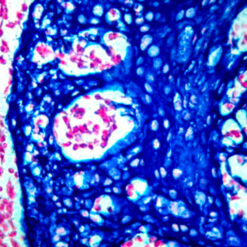 Formalin fixed paraffin embedded human tonsil stained with Cytokeratin H.M.W and labeled with PermaBlue/HRP(K063).