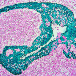 Formalin fixed paraffin embedded human tonsil stained with PermaGreen/HRP.