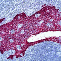 Formalin fixed paraffin embedded human tonsil stained with Cytokeratin H.M.W and labeled with PermaRed/HRP (K075).
