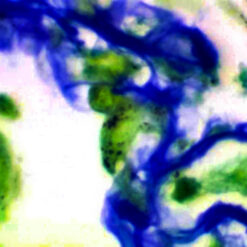 Pneumocystis Stain Kit on pneumocystis in Lung (KT030).