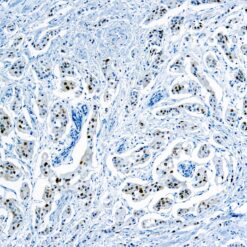 Formalin fixed paraffin embedded human Breast stained with Cyclin D1.