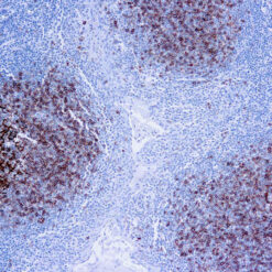 Formalin fixed paraffin embedded human tonsil stained with CD23 antibody