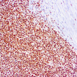 Formalin fixed paraffin embedded human tonsil stained with RPA/p32 antibody