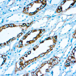 Formalin fixed paraffin embedded human Normal kidney or renal cell carcinoma stained with RCC