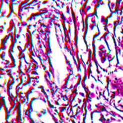 Human liver stained with reticulum stain (KT031)