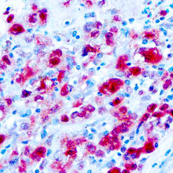 Formalin fixed paraffin embedded human skin stained with S100 antibody