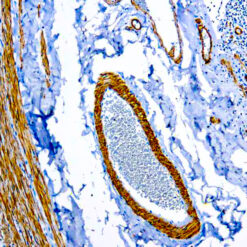 Formalin fixed paraffin embedded human appendix stained with Smooth Muscle Myosin antibody