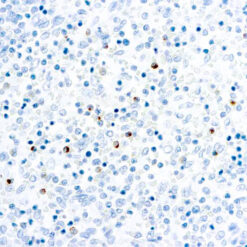 Formalin fixed paraffin embedded human spleen stained with Perforin.