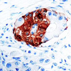 Formalin fixed paraffin embedded human pancreas stained with Synaptophysin antibody.