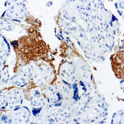 Formalin fixed paraffin embedded human placenta stained with Thrombospodin antibody.