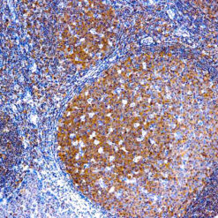 Formalin fixed paraffin embedded human tonsil stained with Bcl-10