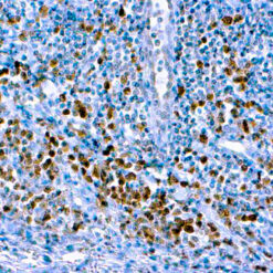 Formalin fixed paraffin embedded human tonsil stained with Caspase 3/CPP32
