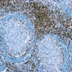 Formalin fixed paraffin embedded human tonsil stained with CD3