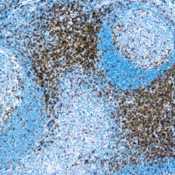 Formalin fixed paraffin embedded human Tonsil stained with CD3.