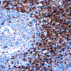 Formalin fixed paraffin embedded human tonsil stained with CD4.