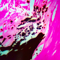 Bone tissue stained with Von Kossa stain (KT028).