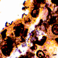 Human Gastric tissue stained with Warthin Starry kit (KT036)