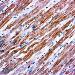 Formalin fixed paraffin embedded human skeletal muscle stained with α-Actinin, Sarcomeric