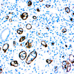 Formalin fixed paraffin embedded human rejected kidney stained with C4D