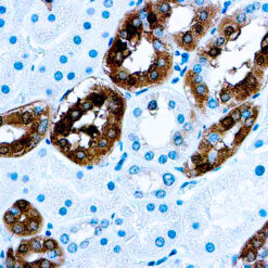 Formalin fixed paraffin embedded human kidney stained with Calbindin-D-28K