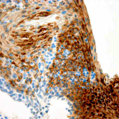 Formalin fixed paraffin embedded human tonsil stained with Cytokeratin 13 antibody.