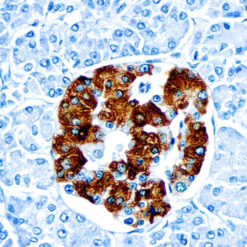 Formalin fixed paraffin embedded human pancreas stained with Insulin antibody.